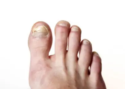 Rochester Foot Care, a podiatrist in Rochester